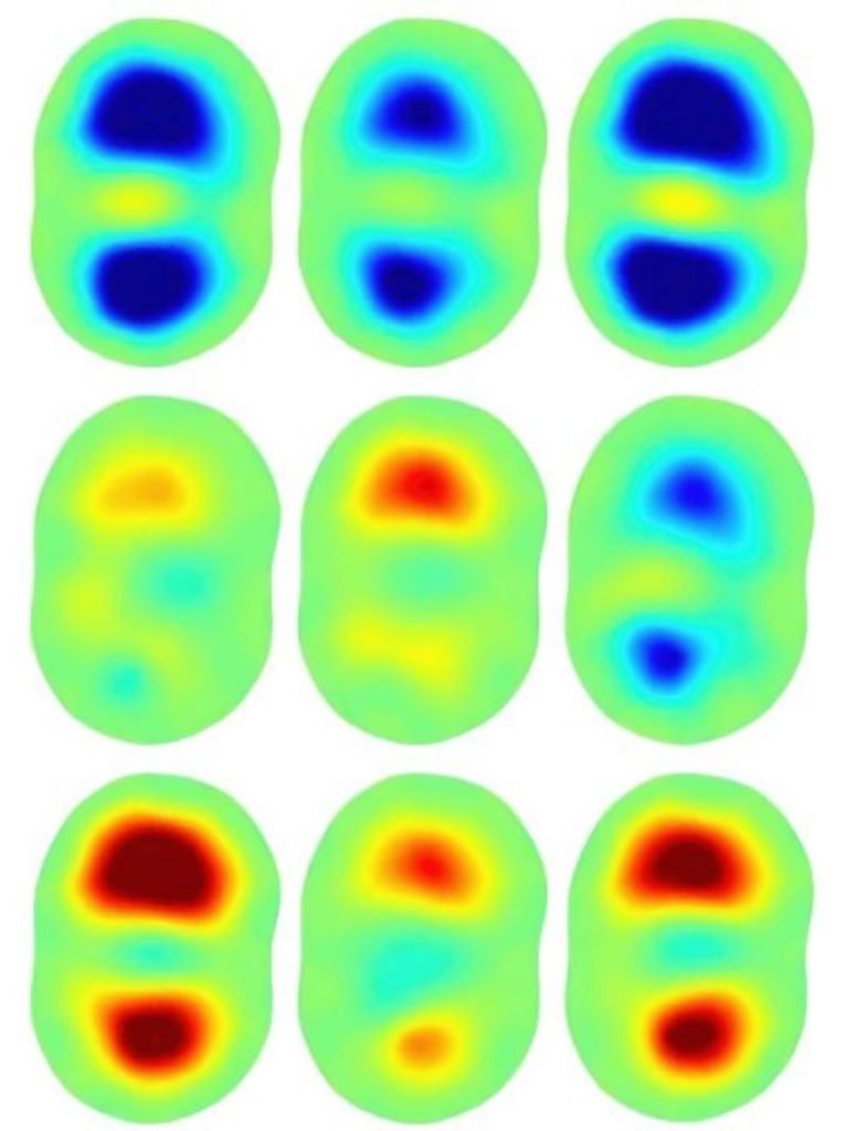 electrical impedance tomography