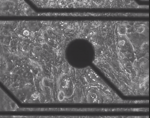 hIPS_derived Cardiomyocytes_60days on the CardioEpix sensor