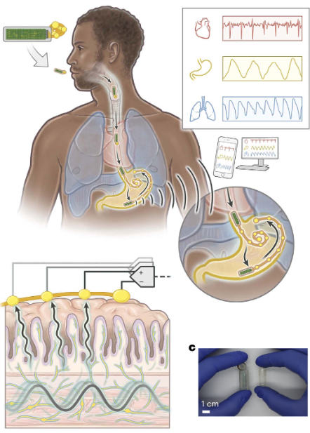 Illustration of a person ingesting a capsule-shaped gut sensor (MiGUT) that monitors internal signals from the stomach using wireless communication and impedance sensors.